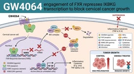GW4064 engagement of FXR represses IKBKG transcription to block cervical cancer growth